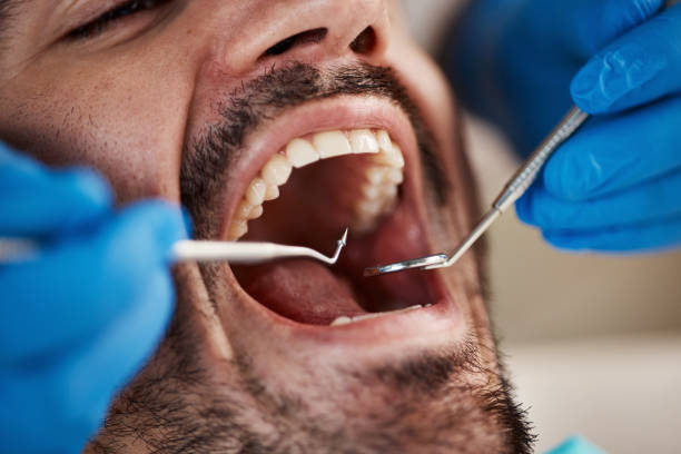 Oral Surgery in Villas, NJ